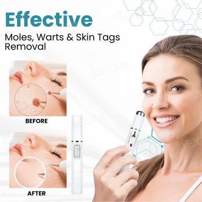 Non-Invasive Mole and Wart Removal Laser Pen