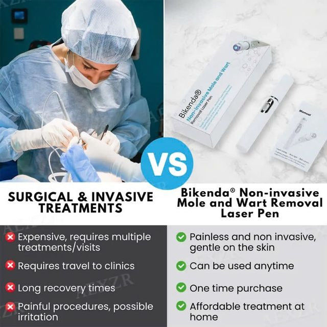 Non-Invasive Mole and Wart Removal Laser Pen